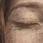 Default image