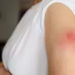 Does Windmilling Your Arm Really Help Vaccine Pain? 