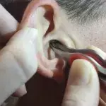 Ear