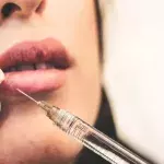 Herpes: Lip fillers can increase your chances of getting cold sores