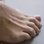 High cholesterol toenails health condition