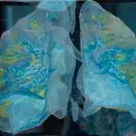 How the coronavirus affects the lungs can be seen for the first time in this video