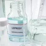 Leprosy cases on the rise: Here's what you should know about this infectious illness
