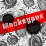 Monkeypox: This unexpected symptom has been revealed by a recent study 