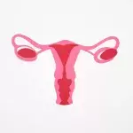 Retroverted uterus