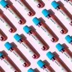Study Shows Women Are Better at Detecting Early Signs of COVID 