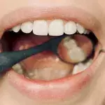 This is what the colour of your teeth says about your oral health