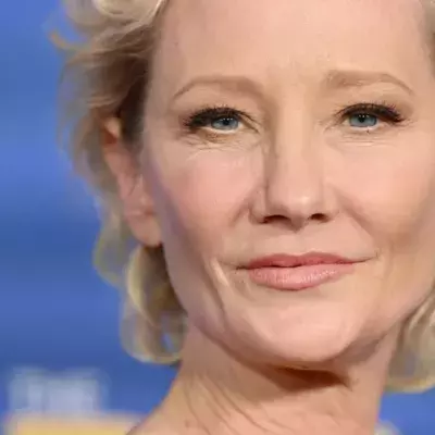 Actress Anne Heche reportedly brain dead after fiery LA crash