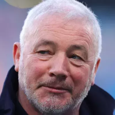 Ally McCoist Dupuytren's contracture