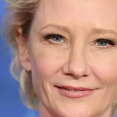Anne Heche had to wait for 45 minutes before she could get any lifesaving measures 