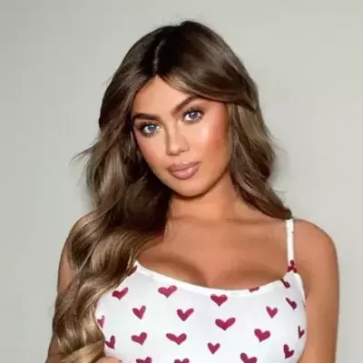 Belle Hassan opens up about attack that left her with a black eye