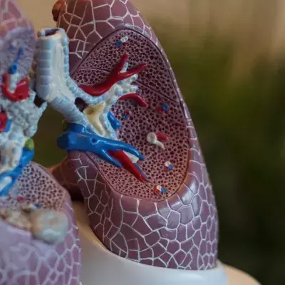Chelsie Whibley: What is cystic fibrosis, the disease she died fighting?