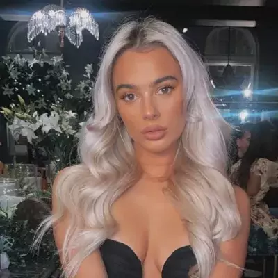 Lillie Haynes: Love Island star left unable to open mouth after plastic surgery