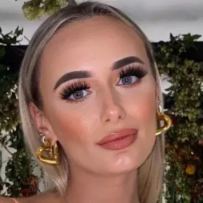 Millie Court opens up about adult acne struggle