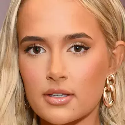 Molly-Mae Hague opens up about endometriosis surgery