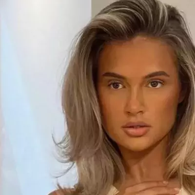 Molly-Mae: a skin condition that made her hide her arms for a year is back