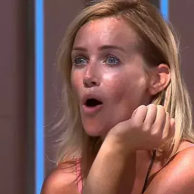Laura Anderson Slams Plastic Surgery Claims After 'Unrecognisable' Photos