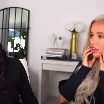 The Love Island star got fillers in her jaw at just 18