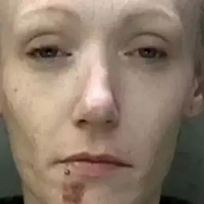 This 36-Year-Old Was Severely Addicted to Heroin