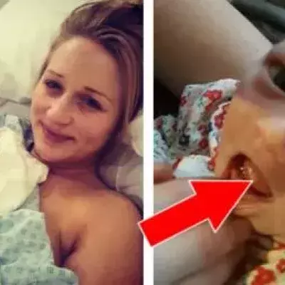 This baby already had 2 teeth when she was born!