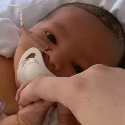Baby’s stomach balloons up hours after being born, leaving mum scared