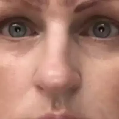 A botched microblading procedure left this woman with 4 eyebrows