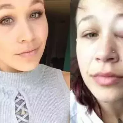 In Canada, a woman got the inside of her eyelid tattoed, and ended up with a serious infection.