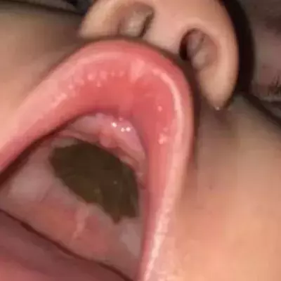 A Dark Spot in Her Baby's Mouth Made for an Embarrassing Doctor's Visit