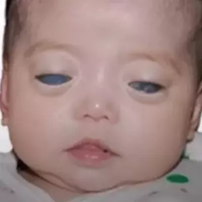Default image