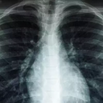 Doctors shocked to find this fragile object inserted in man's anus