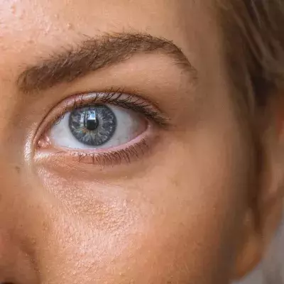 doctors shocked woman eye infection worms health