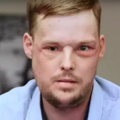 This is the emotional moment a woman met the man who received her late husband's face 