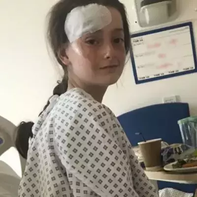 This Girl Has Severe Burns After Poached Egg Explodes in Her Face