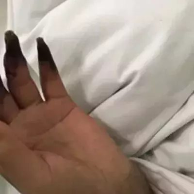 Her Hands Turned Black After Cleaning Her House.