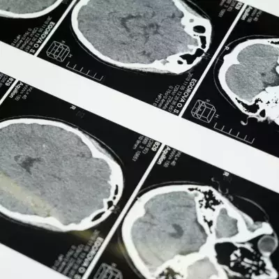 man chopsticks lodged in the brain for 5 months