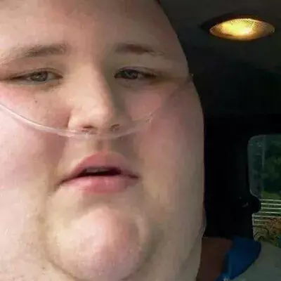 This Obese Young Man's Life Was Hanging By A Thread, 