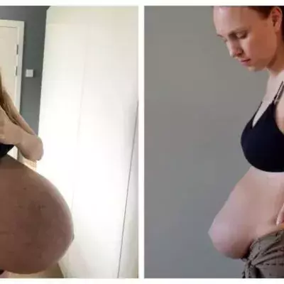 tummy