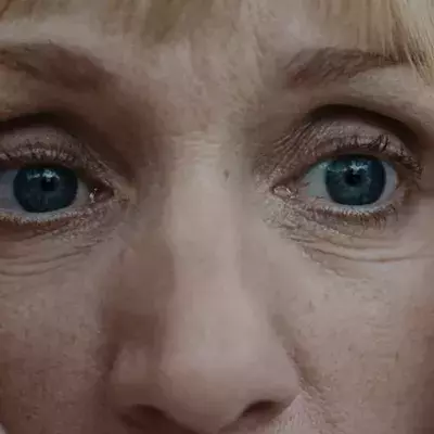 Woman pulls 14 worms out of her eye after it got irritated (VIDEO)