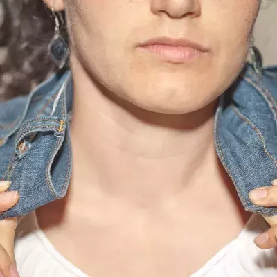 Default image
