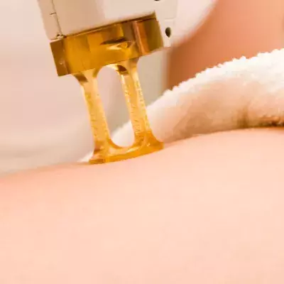 This is everything you need to know before your laser hair removal appointment