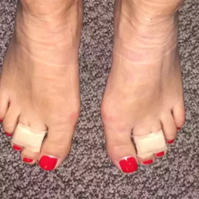 She Ties Her 3rd And 4th Toes Together For An Amazing Reason!