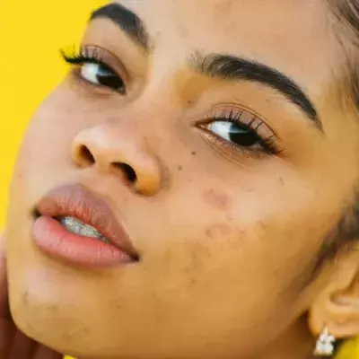 Skinceptance: Superdrug announces new free skin consultation service