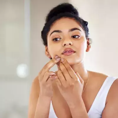 Ten Common Acne Myths and Why They Aren’t True