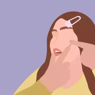 These are the 3 mistakes we all make when dealing with a spot