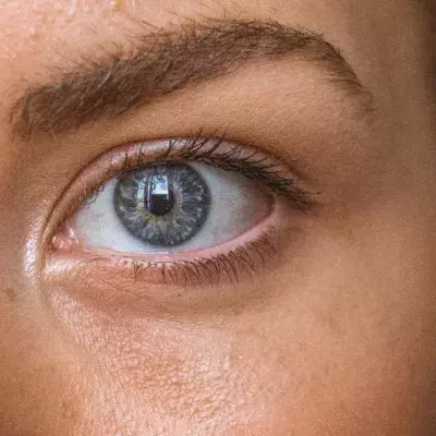 Tips and Tricks: get rid of undereye bags with these 5 tricks 