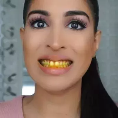 Whitener