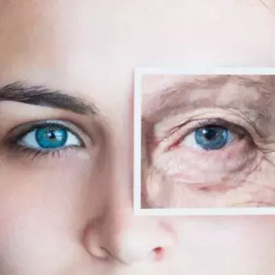 Default image