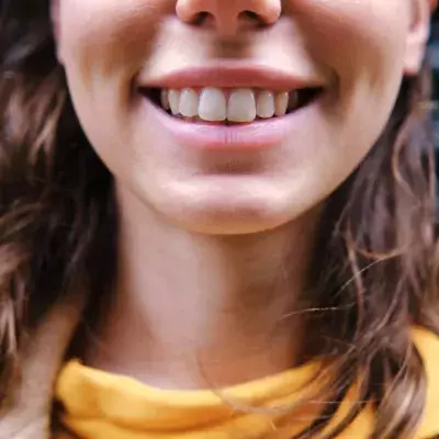 These foods can stain your teeth