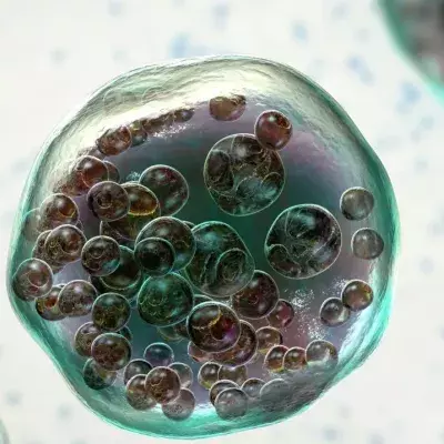 Biblical disease making a terrifying comeback in UK as cases soar