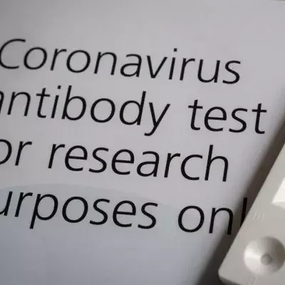 COVID-19 Antibody tests to be offered to the public